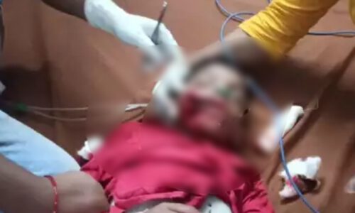 पटाखा फोड़ने के दौरान एक बच्चा बुरी तरह घायल