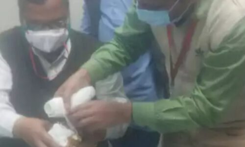 आगरा –डॉक्टर ने किया भगवान के टुटे हाथ का प्लास्टर जानें पूरा मामला ।