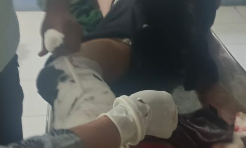 मनिहारी में टोटो-बाइक की टक्कर में युवक घायल, प्राथमिक उपचार के बाद कटिहार रेफर