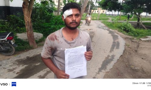 ग्राम कचहरी से लौटते युवक पर जानलेवा हमला, सिर पर गंभीर चोट।