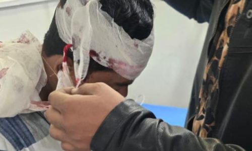 रेलवे पाइलिंग के कॉन्टेक्ट ठेकेदार से पिस्टल दिखाकर रंगदारी मांगने का मामला थाना में दर्ज